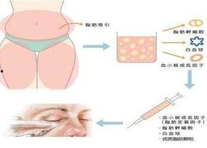 做假体鼻子视频,跟随视频学习专业技巧