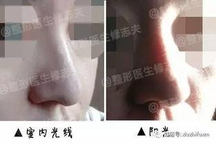 做假体鼻子视频,跟随视频学习专业技巧