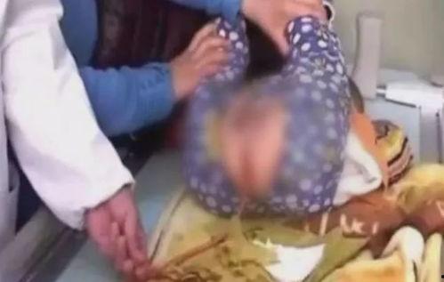 儿童生病灌肠视频